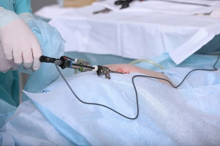 Laparoscopic Hernia Surgery