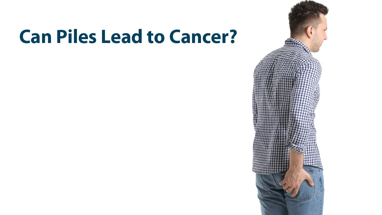 Can Piles Lead to Cancer?