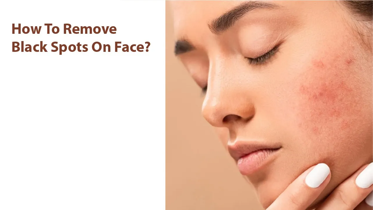 How to Remove Black Spots on Face?