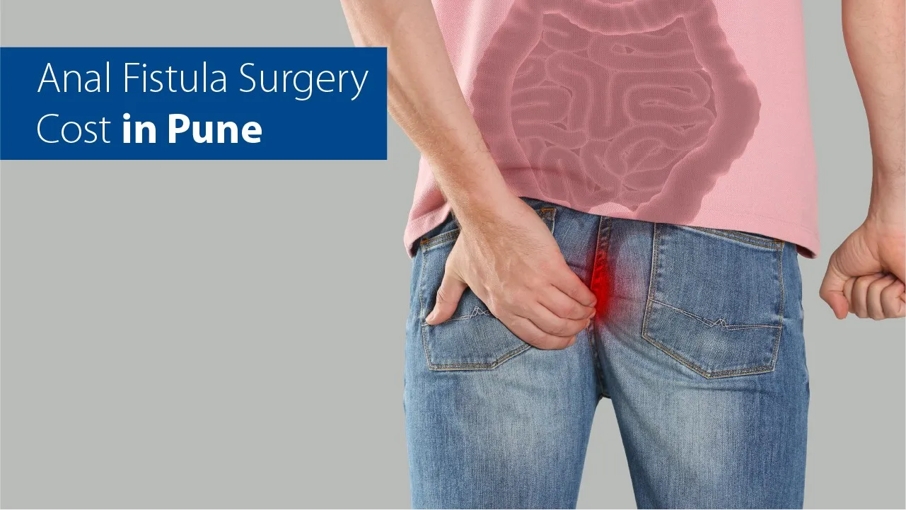 Anal Fistula Surgery Cost in Pune