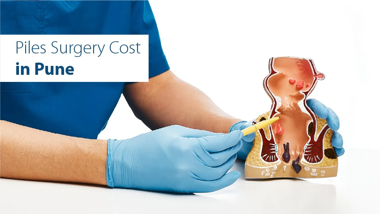 Piles Surgery Cost in Pune