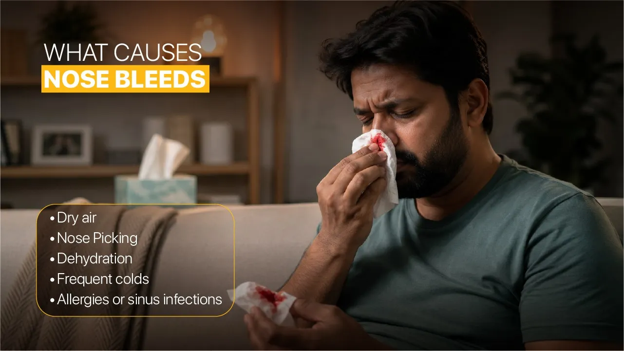 What Causes Nose Bleeds?